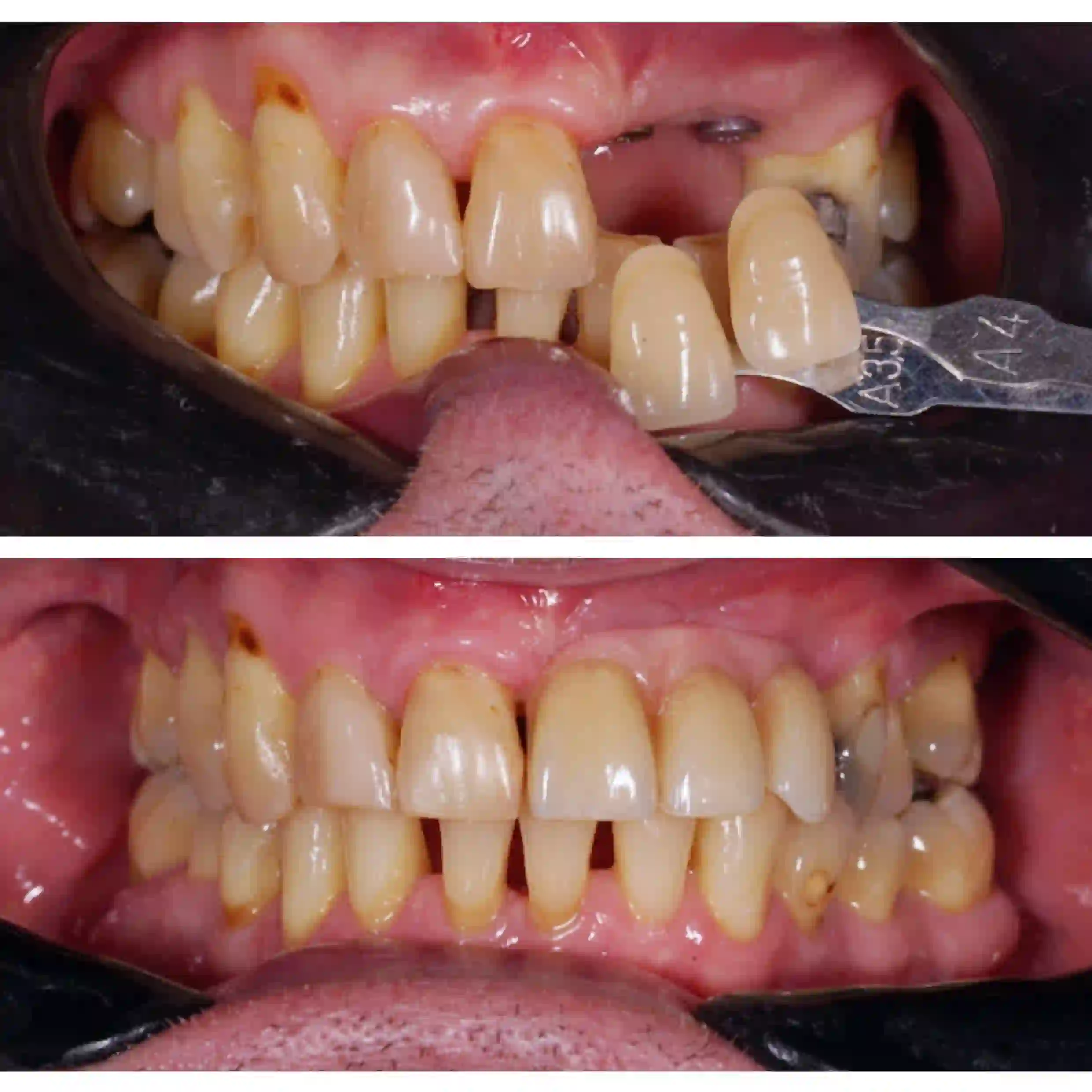 This image for Image Layouts addon